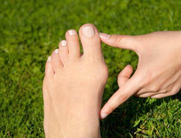 halluks valgus ameliyatı